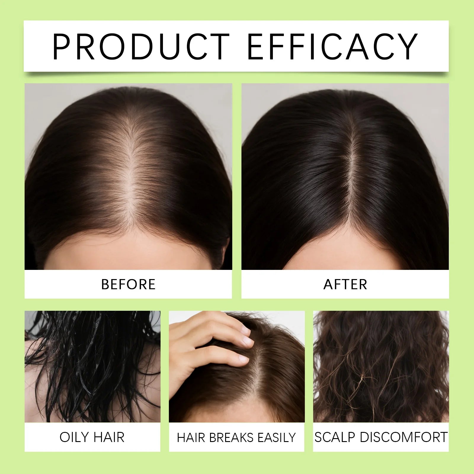 Hair-Growth Derma Roller & Serum Kit