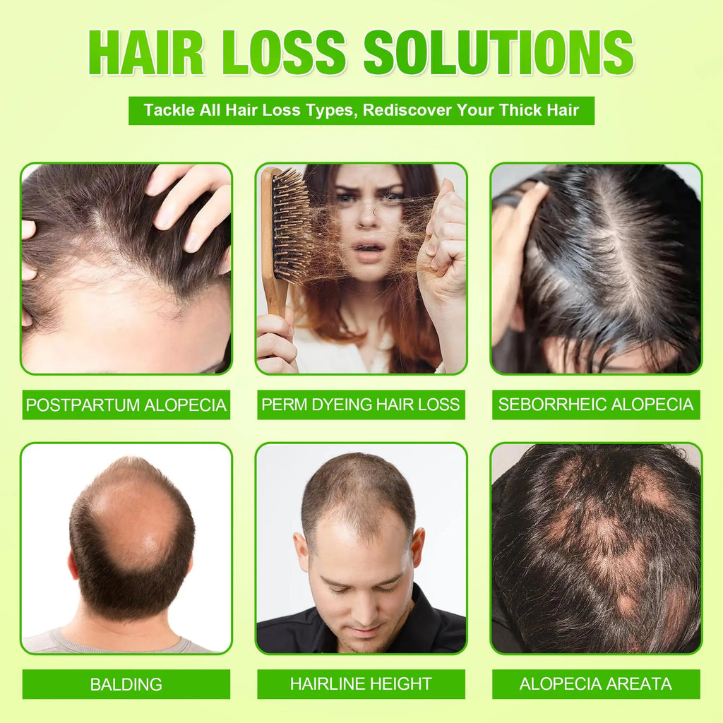Hair-Growth Derma Roller & Serum Kit