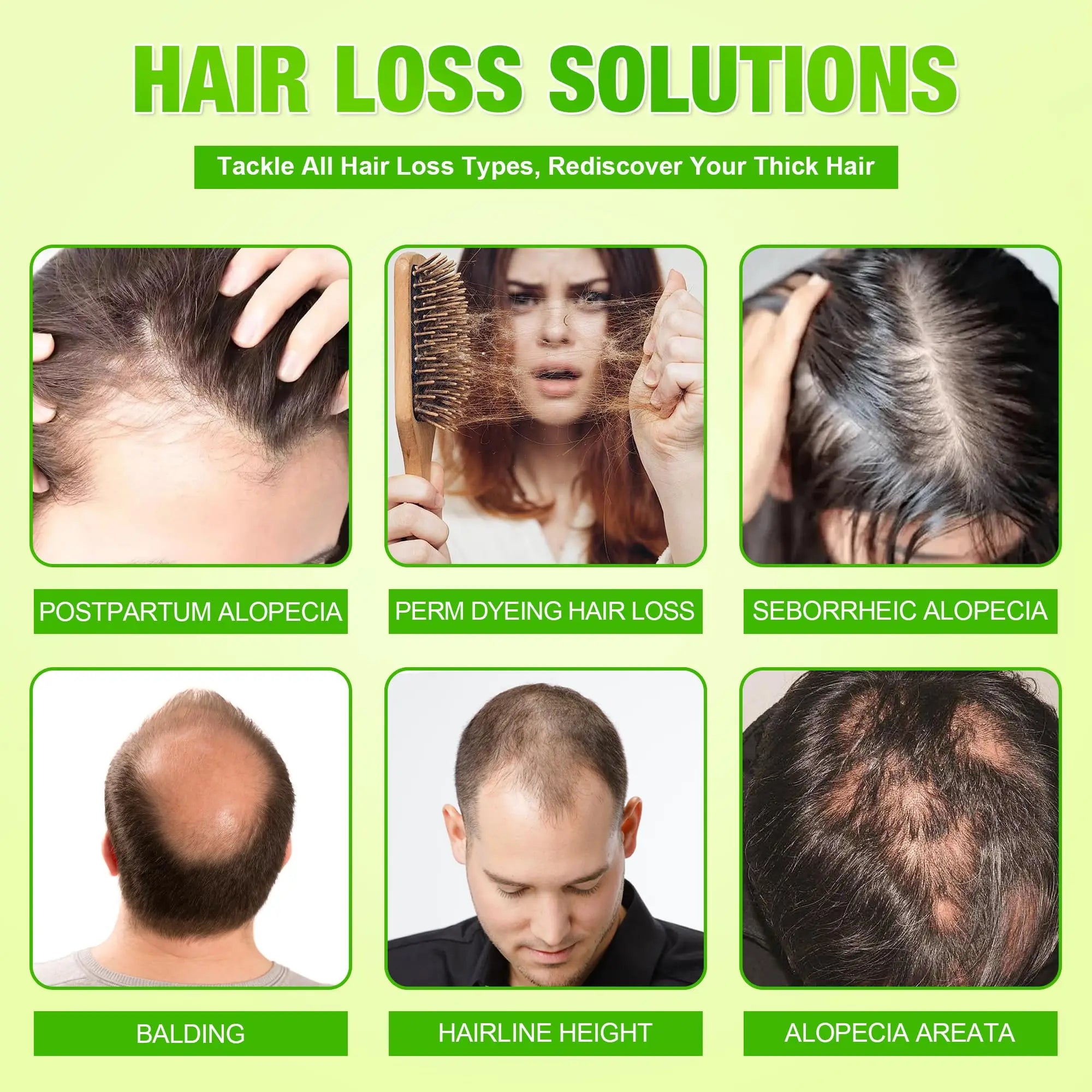 Hair-Growth Derma Roller & Serum Kit