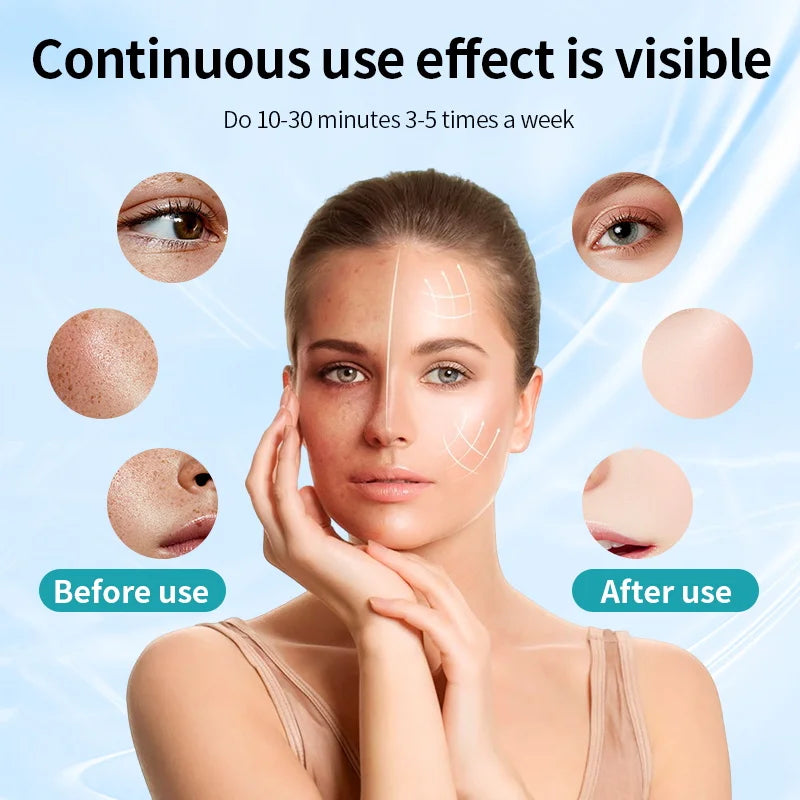 Red-Light Therapy LED Mask